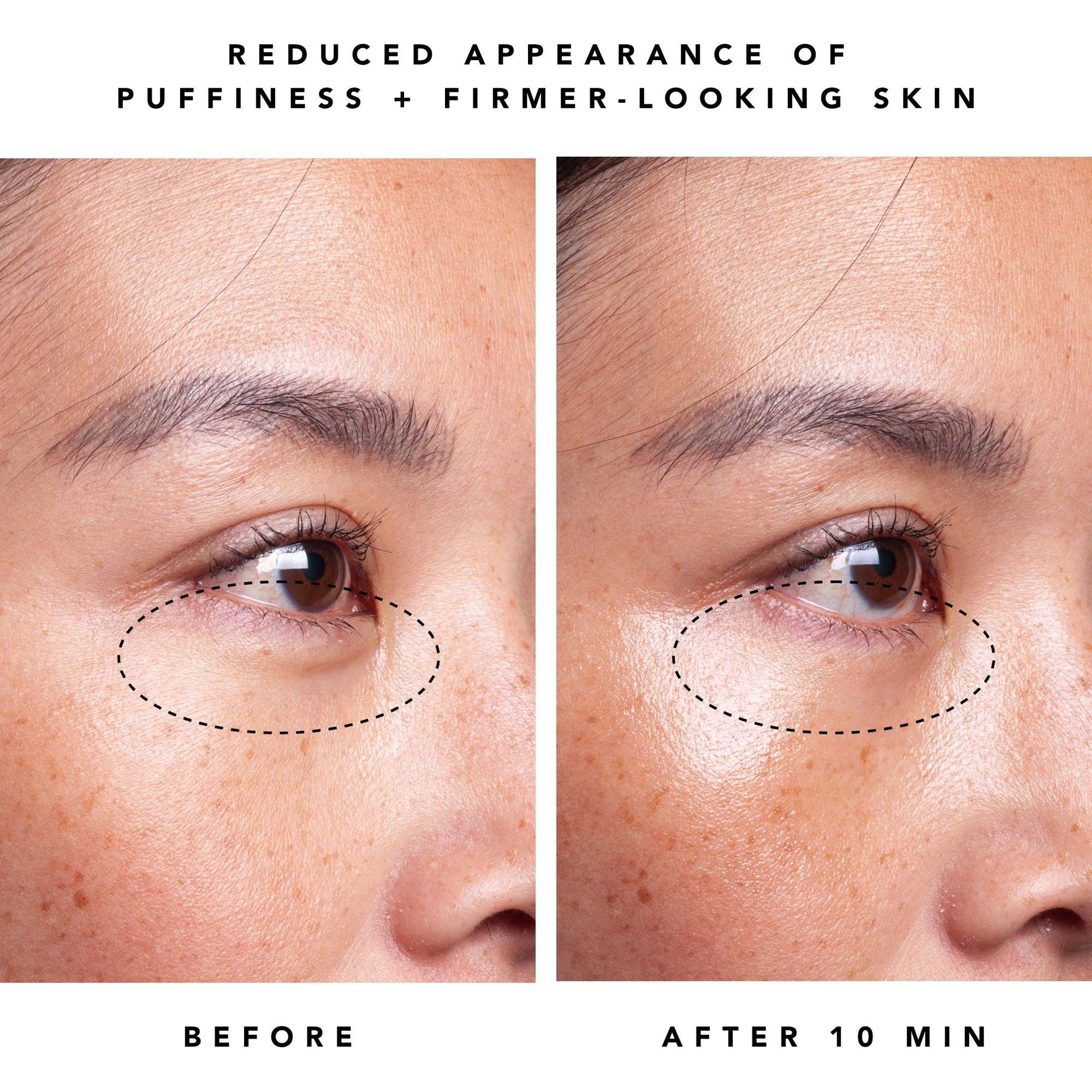 Herbivore Botanicals - Moon Dew 1% Bakuchiol + Peptides Retinol Alternative Eye Cream - Dear John